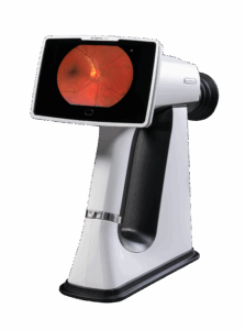 Optomed Lumo Retinal Camera