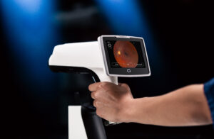 Hand holding Optomed Lumo Retinal Camera